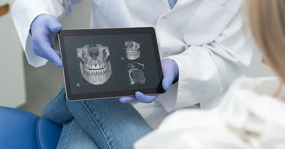 seven_star_dental_blog-8