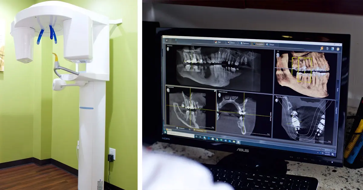 seven_star_dental_technology-cone-beam-xrays